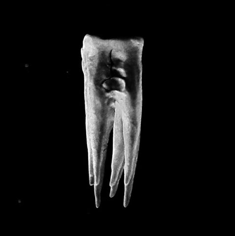 CHALK TEETH - s/t LP (colour vinyl)