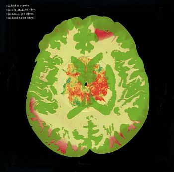 MINUS 5 - Stroke Manor LP (colour vinyl)